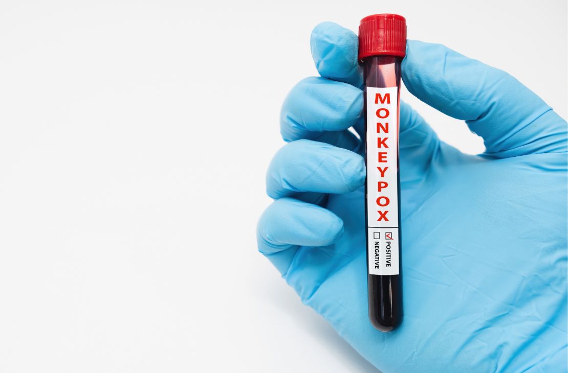 Varíola dos macacos: com 813 casos, Brasil tem situação 