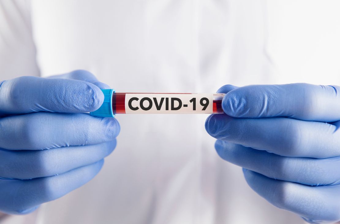Brasil tem 27.086 casos de covid-19 e 105 mortes em 24 horas