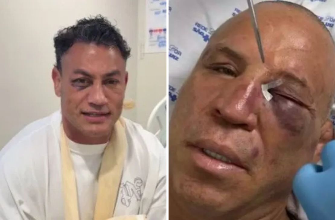 Conselho Nacional de Boxe anuncia suspensão de Popó e Wanderlei Silva