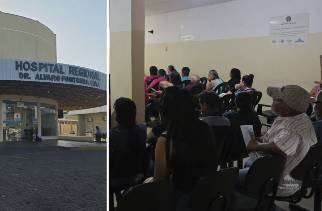 Hospital Regional de Coxim dá início a mutirão para a realização de 400 cirurgias de catarata